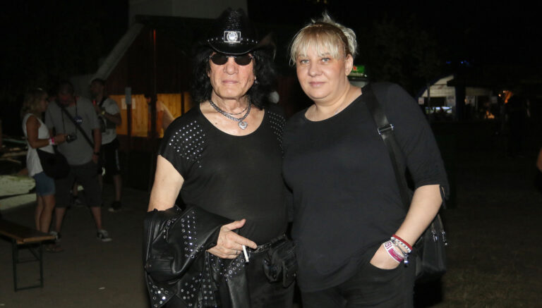 Milić Vukašinović progovorio o zdravstvenom stanju posle amputacije noge: „Kad su mi rekli da će je odseći…“