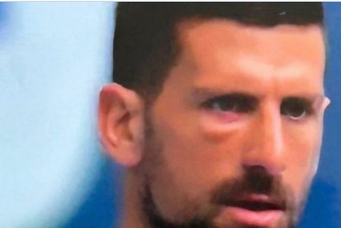 Novak ima problem sa otečenim okom pred finale Majamija