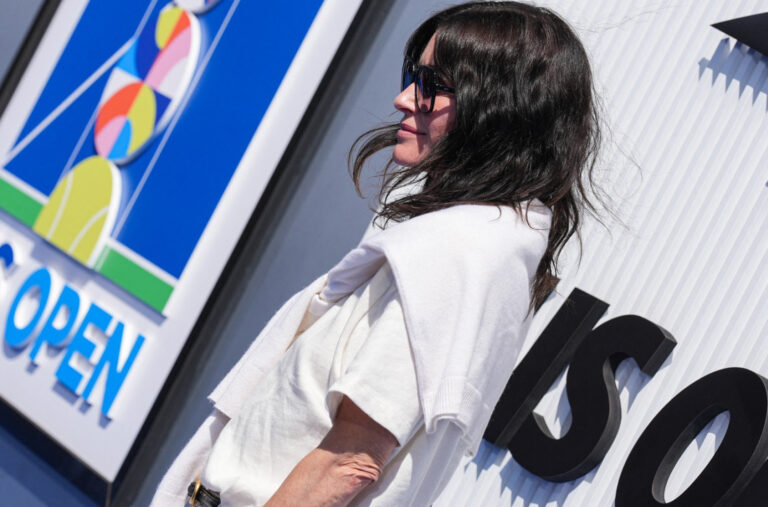 Čuvena ljepotica kasno shvatila da fileri nisu njen prijatelj, pa sad ne može da sakrije posljedice FOTO