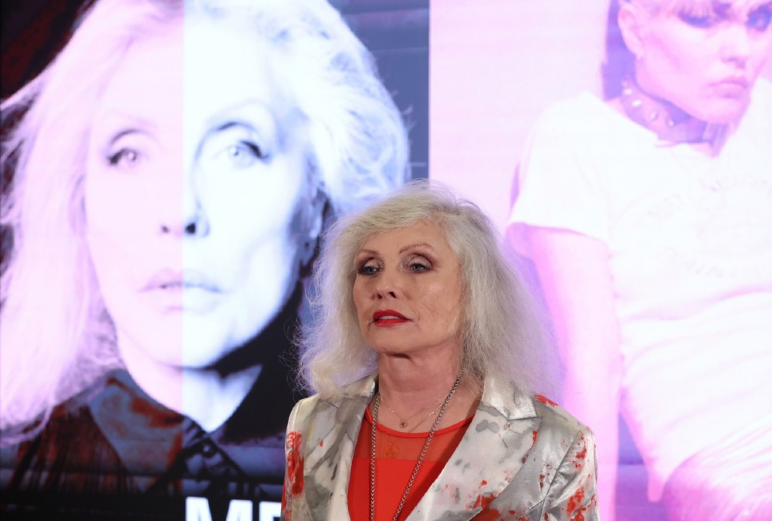 Pevačica kultne grupe otkrila sve o operacijama: Bile su potrebne za moju karijeru