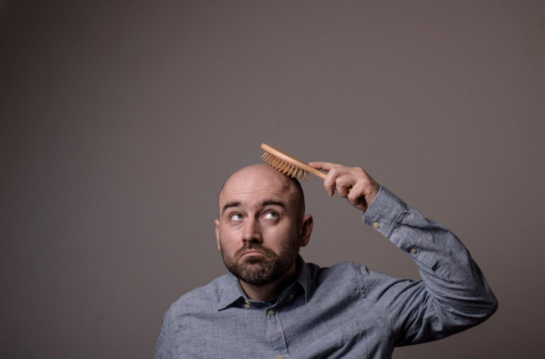 Da li epitet „ćelavi“ predstavlja seksualno uznemiravanje? Slučaj pokrenuo raspravu