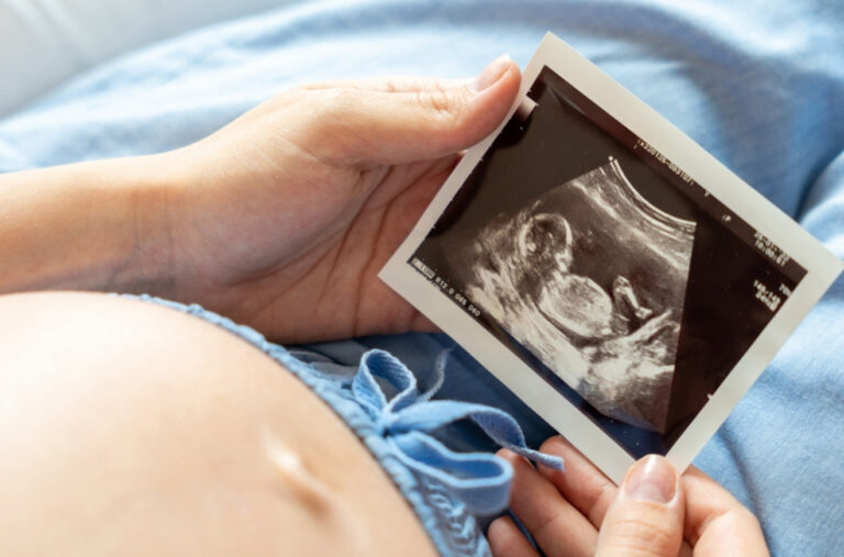 Dokažite da ste začeli u ovom hotelu: Osvojićete vrednu nagradu