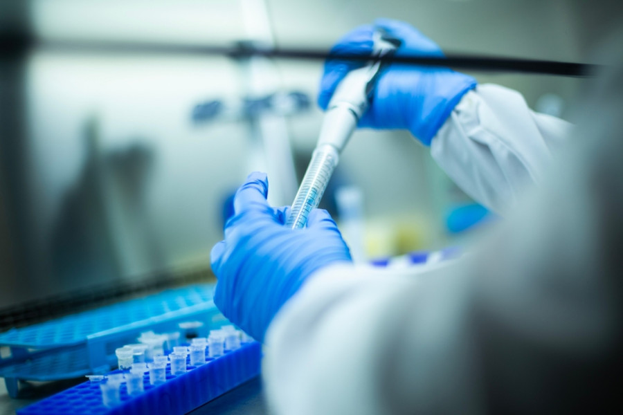 Zabrinjavajuće otkriće: Visok nivo hemikalija koje oštećuju mozak