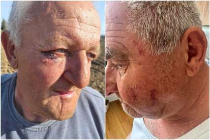 Dvojica penzionera tvrde da ih je pretukla policija: Slučaj iz Banjaluke otvara ozbiljna pitanja o upotrebi prekomjerne sile